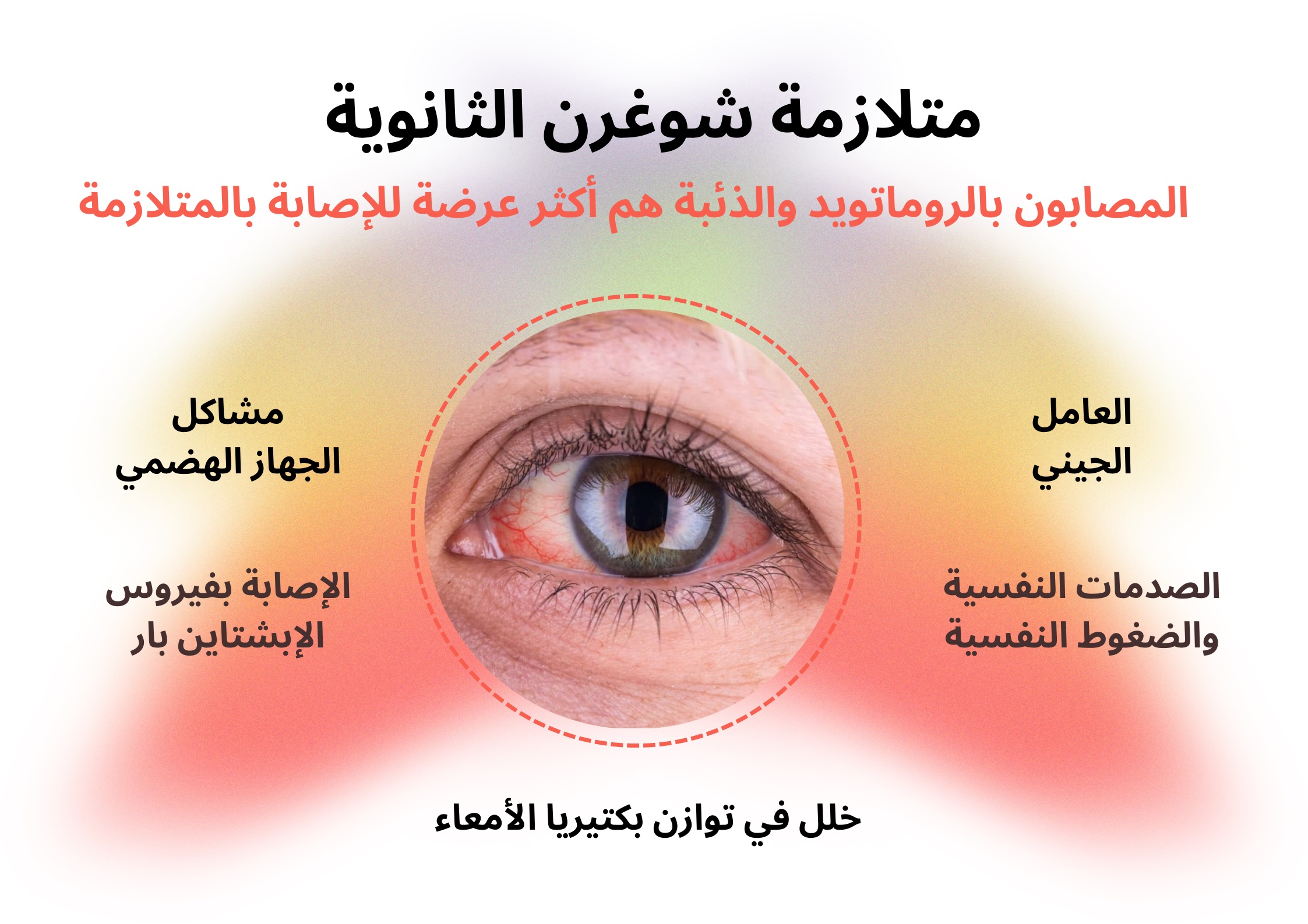 متلازمة شوغرن الثانوية	