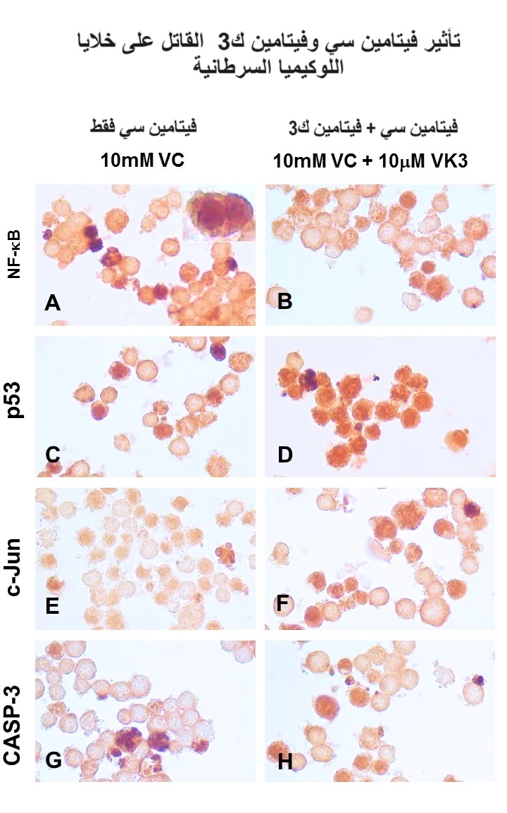 تأثير فيتامين سي وفيتامين ك3 على قتل خلايا اللوكيميا السرطانية	