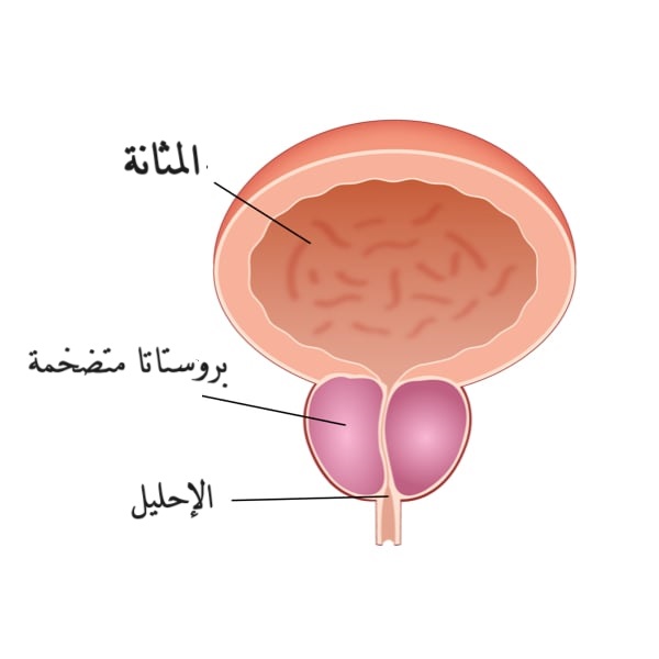 البروستاتا