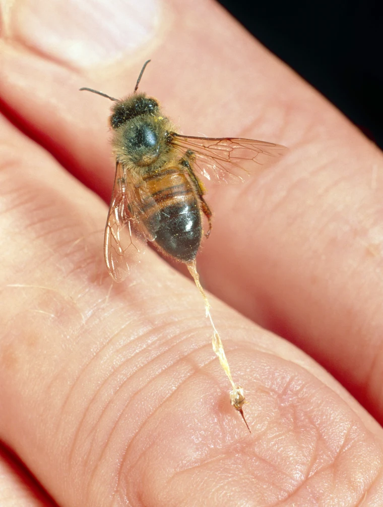 	العلاج بسم النحل