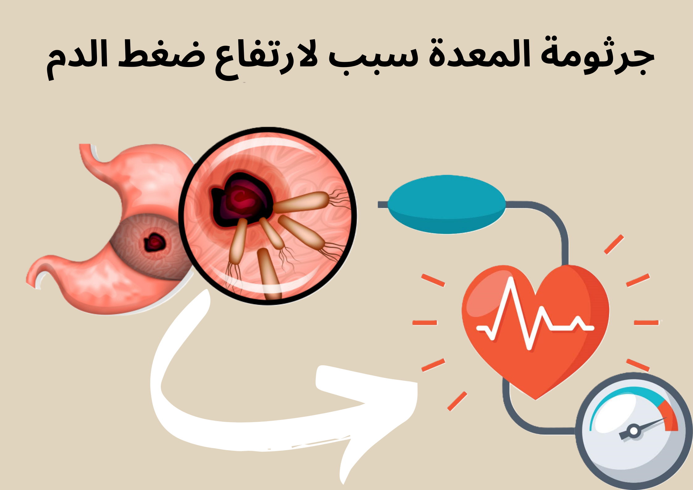 جرثومة المعدة سبب لارتفاع ضغط الدم	