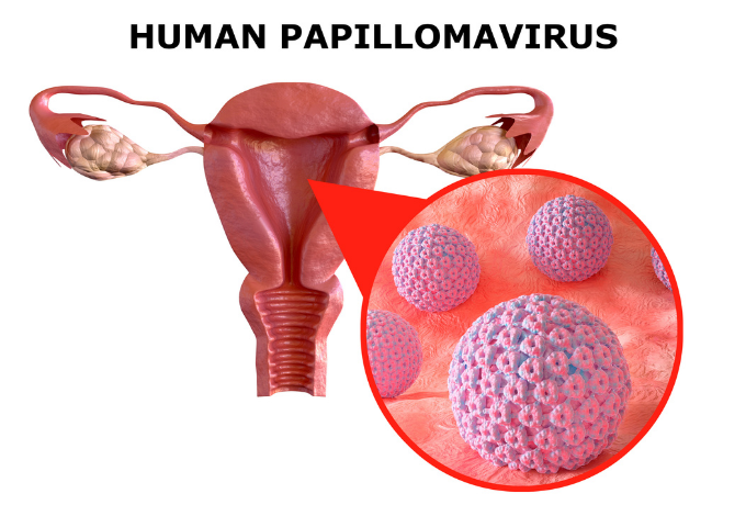 Human Papillomavirus (HPV)	
