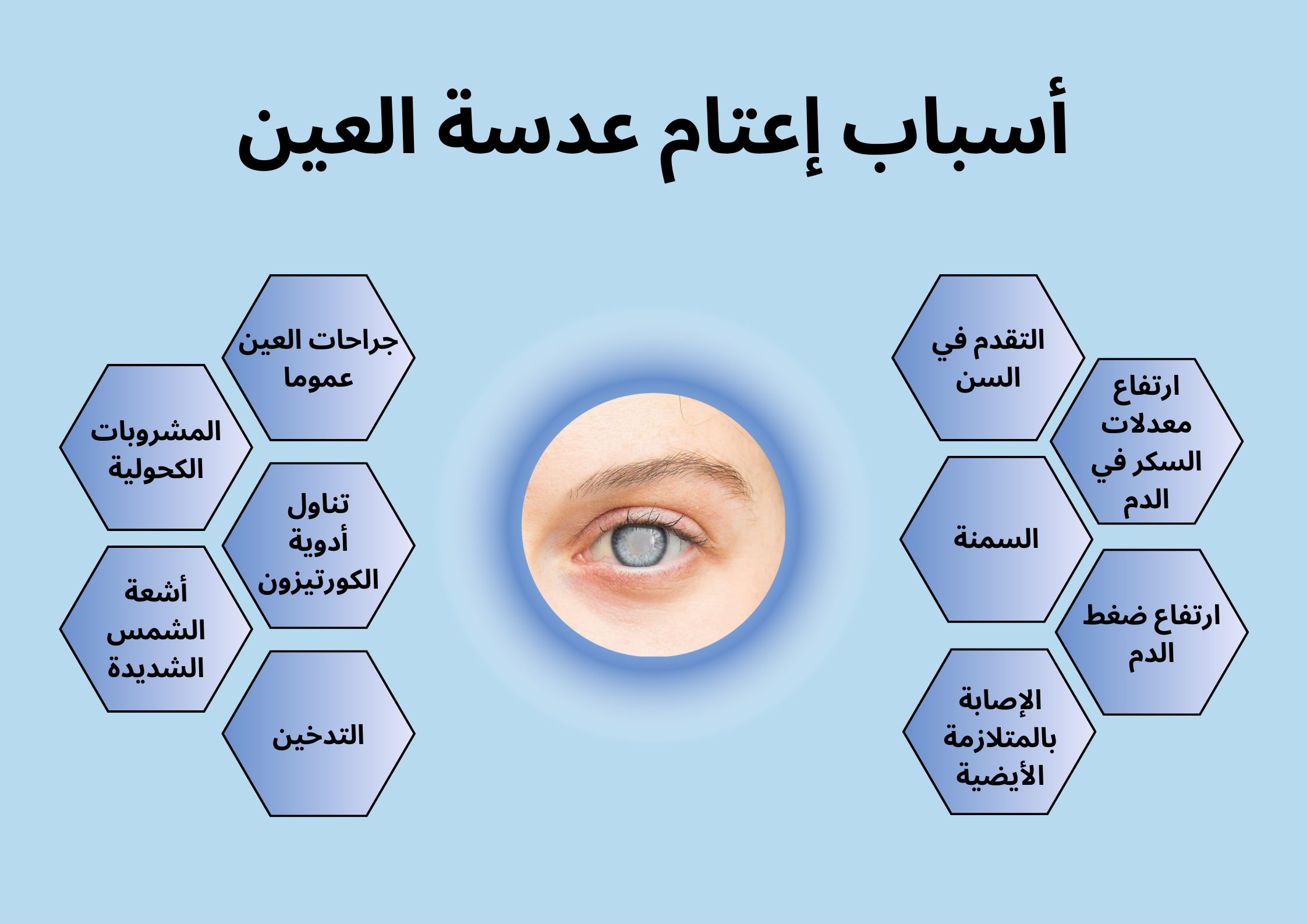 أسباب إعتام عدسة العين	