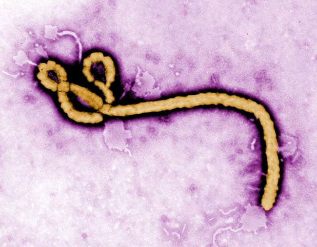 فيروس إيبولا