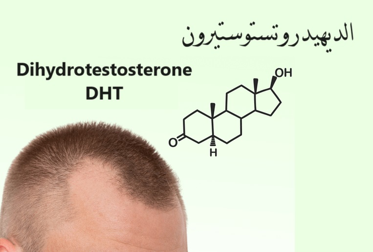 Dihydrotestosterone الديهيدروتستوستيرون	