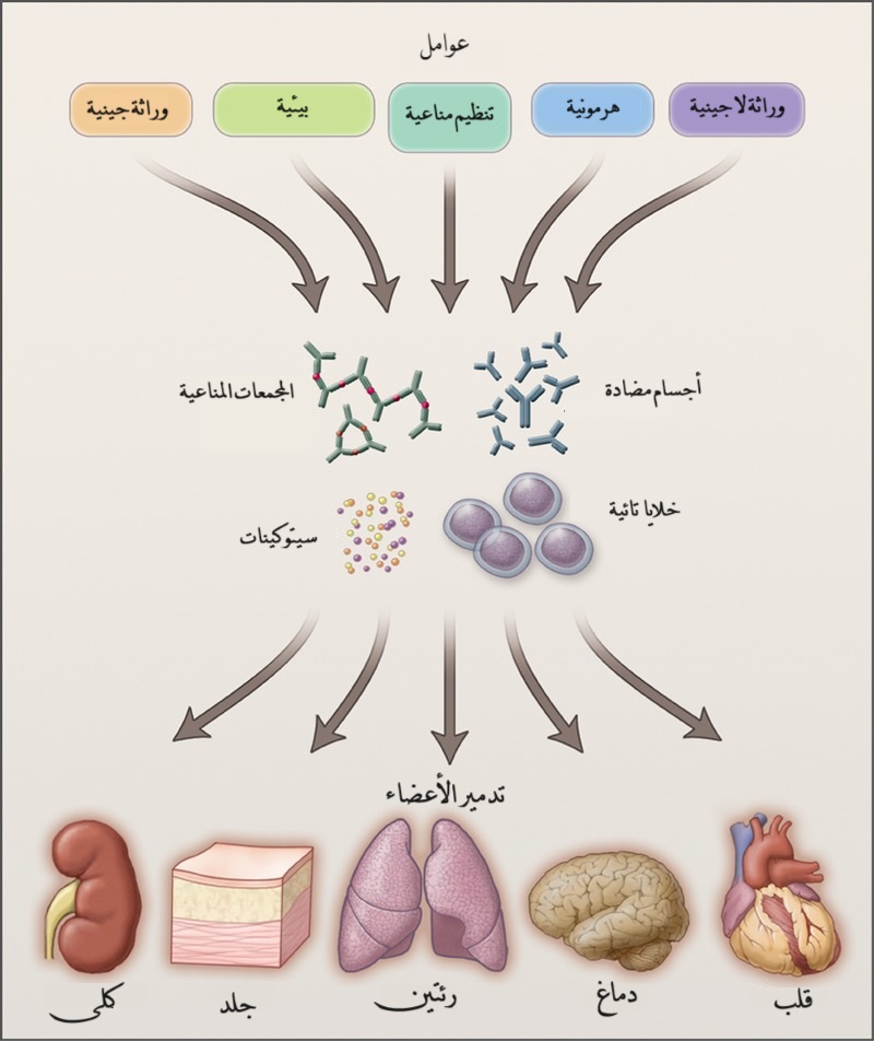 العوامل التي تسبب الذئبة والأعضاء التي تؤثر عليها الذئبة