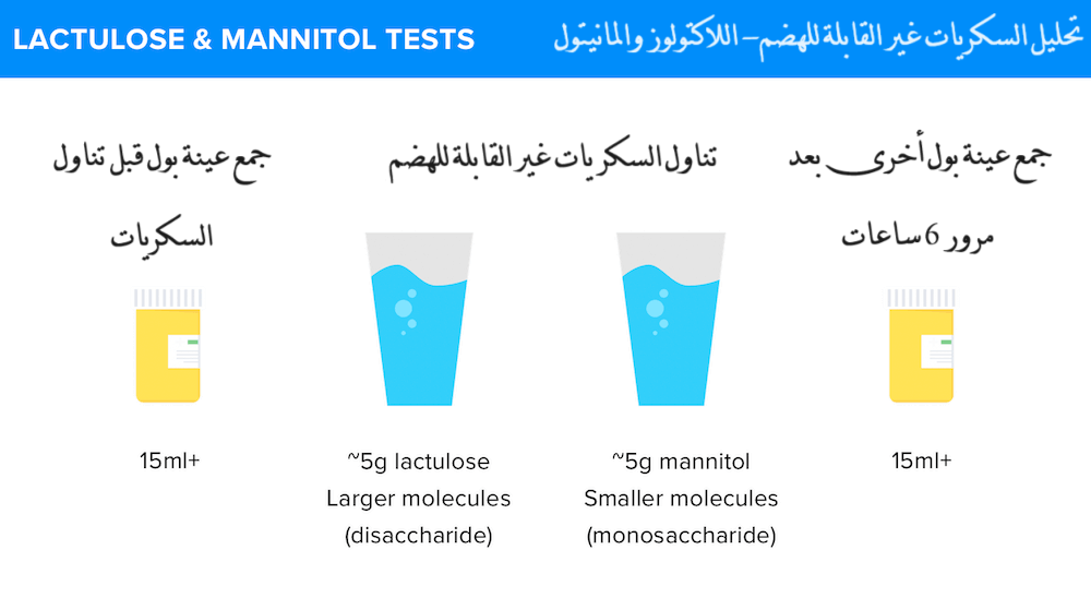 تحليل السكريات في البول اللاكتولوز والماانيتول (lactulose and mannitol (LM) test)	