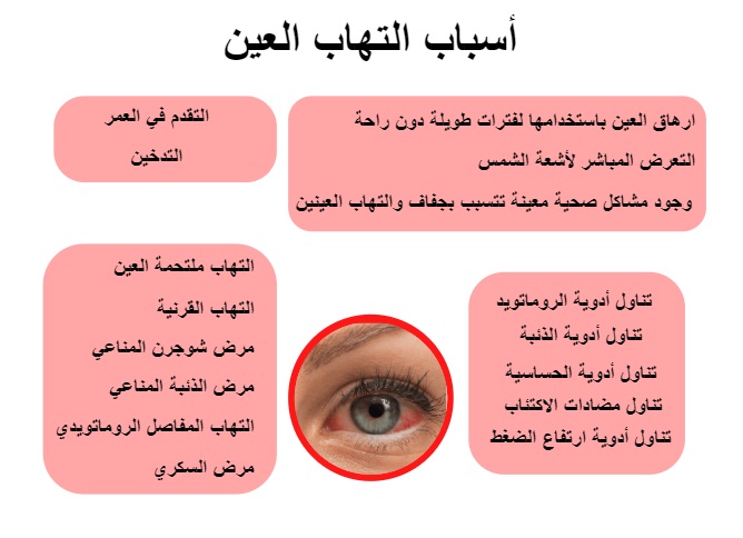 أسباب التهاب العين	