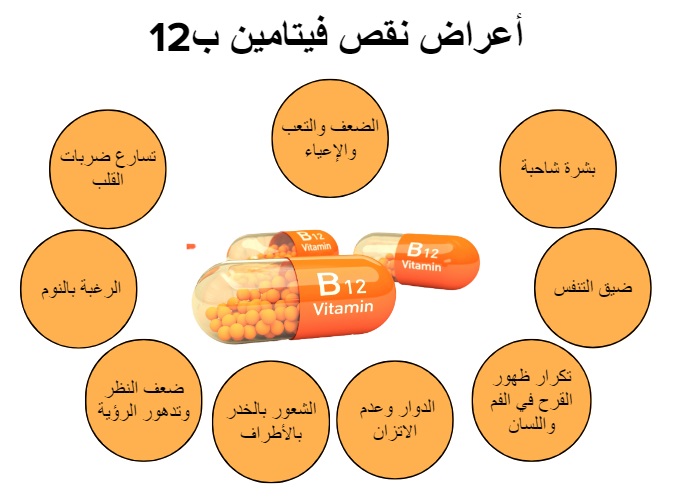 أعراض نقص فيتامين ب12	