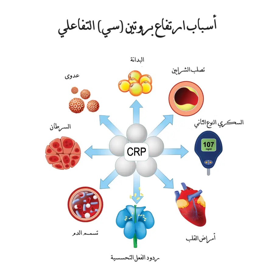 CRP بروتين سي التفاعلي	