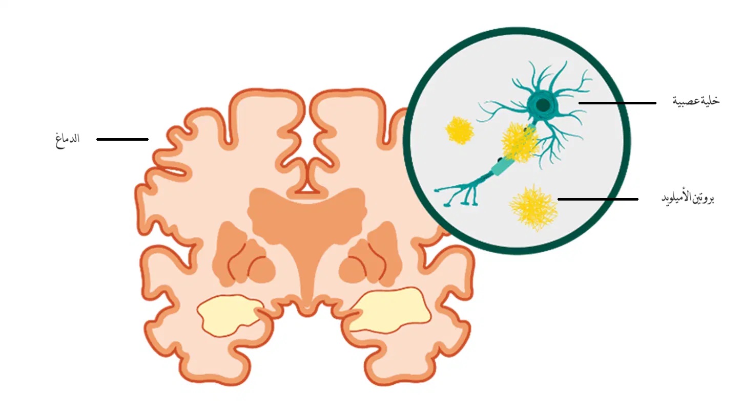 Amyloid protein