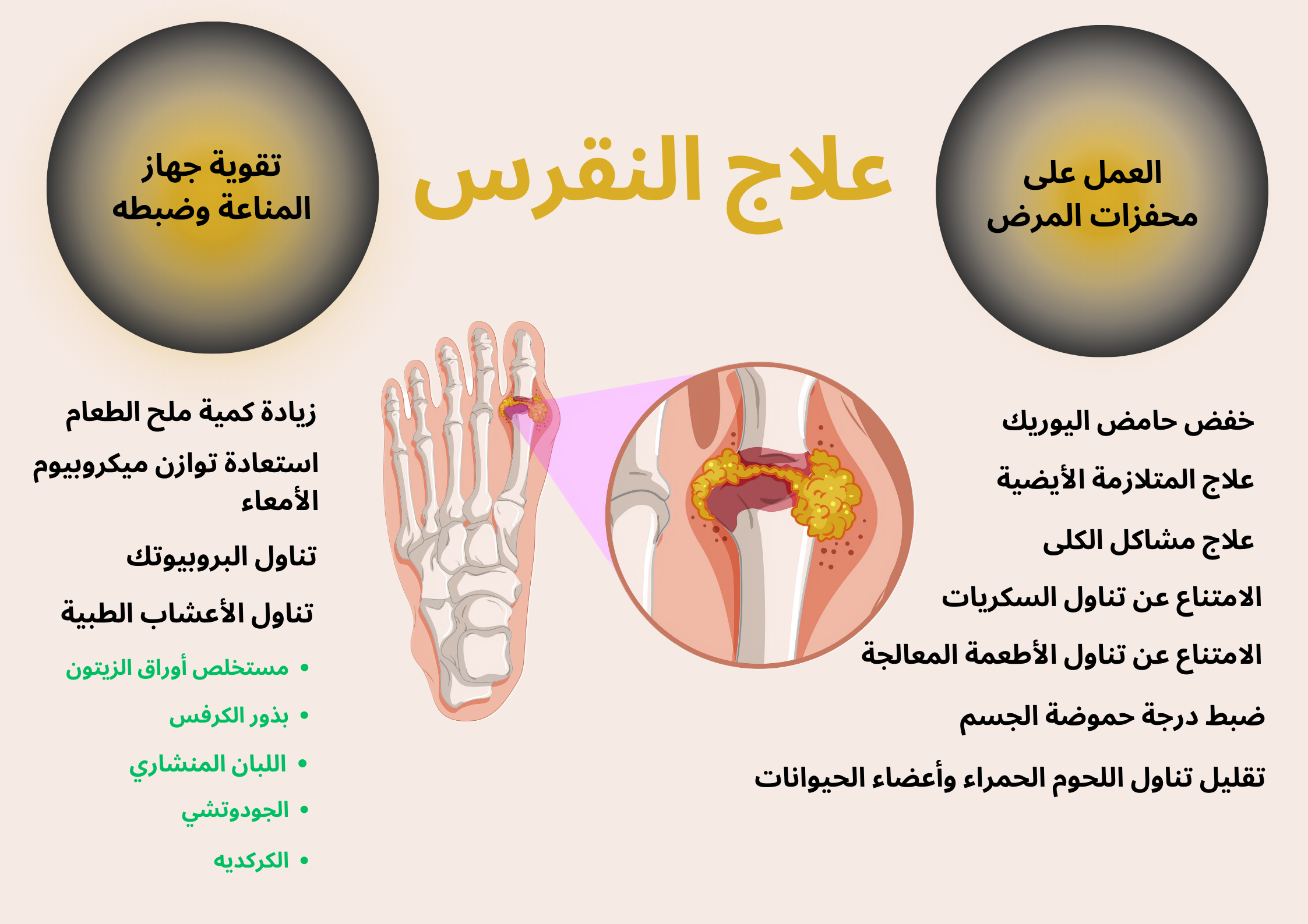 علاج النقرس