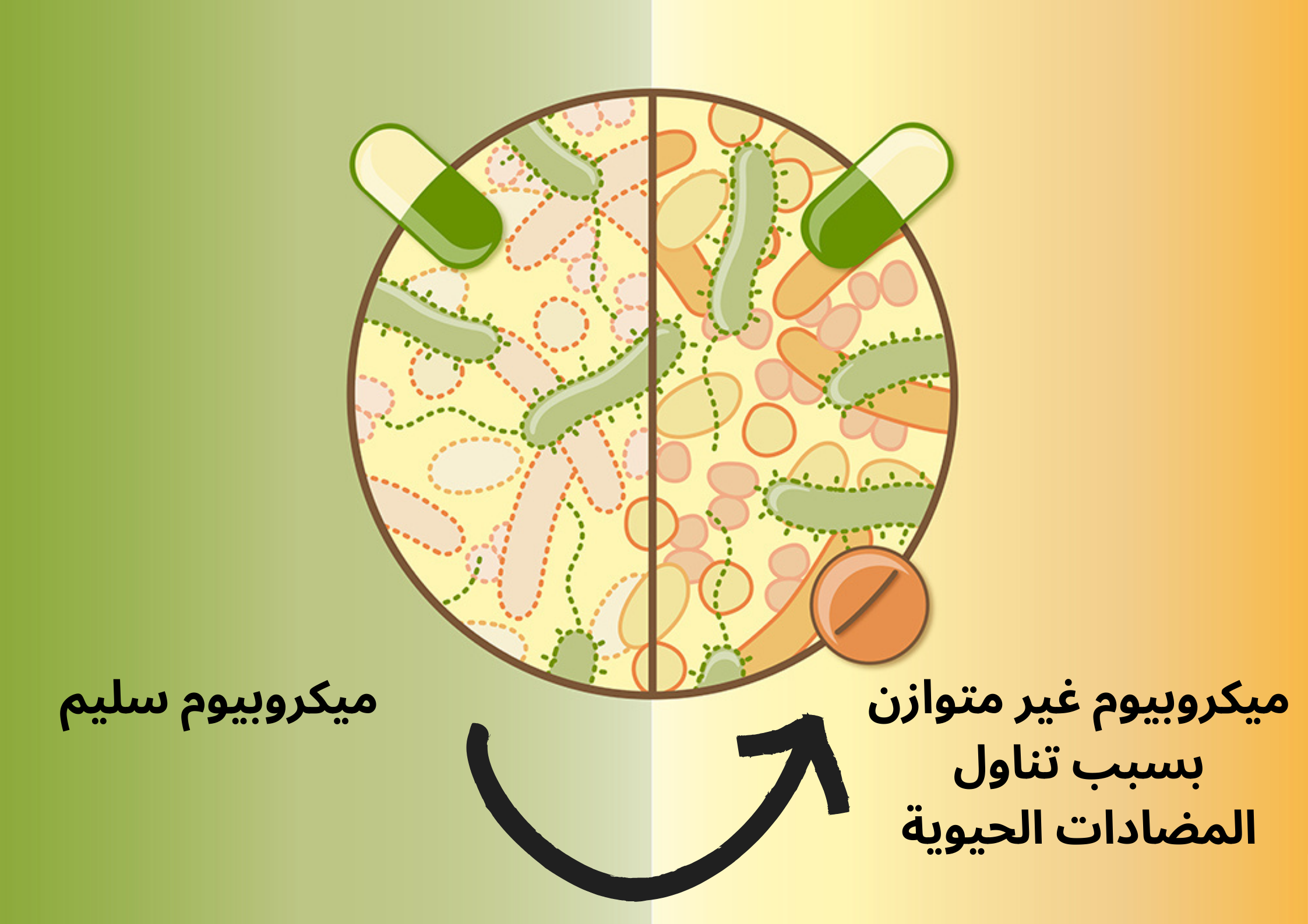 خلل في التوازن البكتيري	