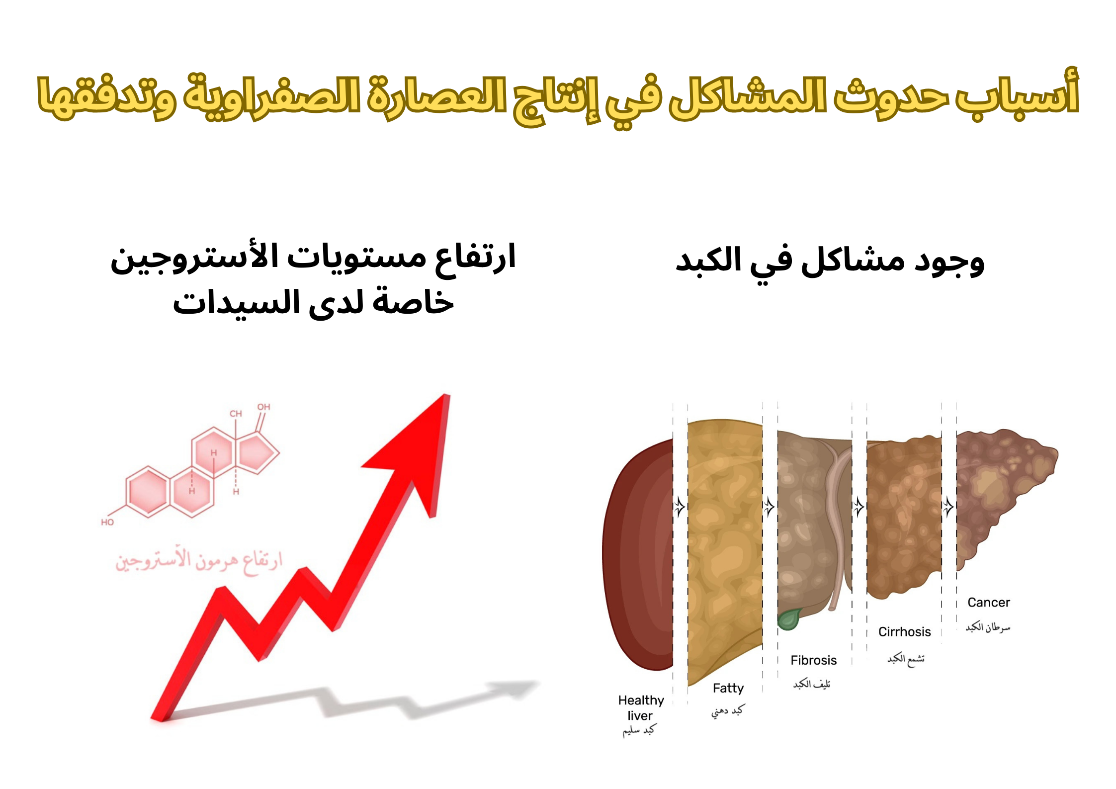 أسباب حدوث المشاكل في إنتاج العصارة الصفراوية وتدفقها