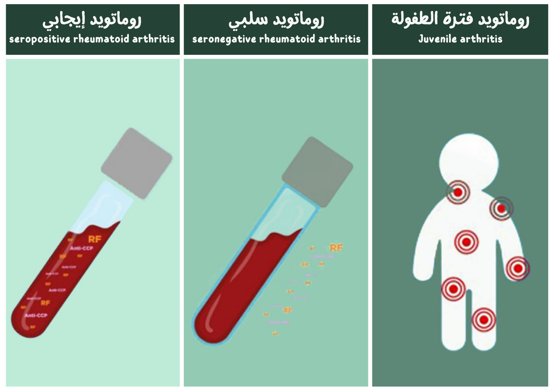 أنواع التهاب المفاصل الروماتويدي	