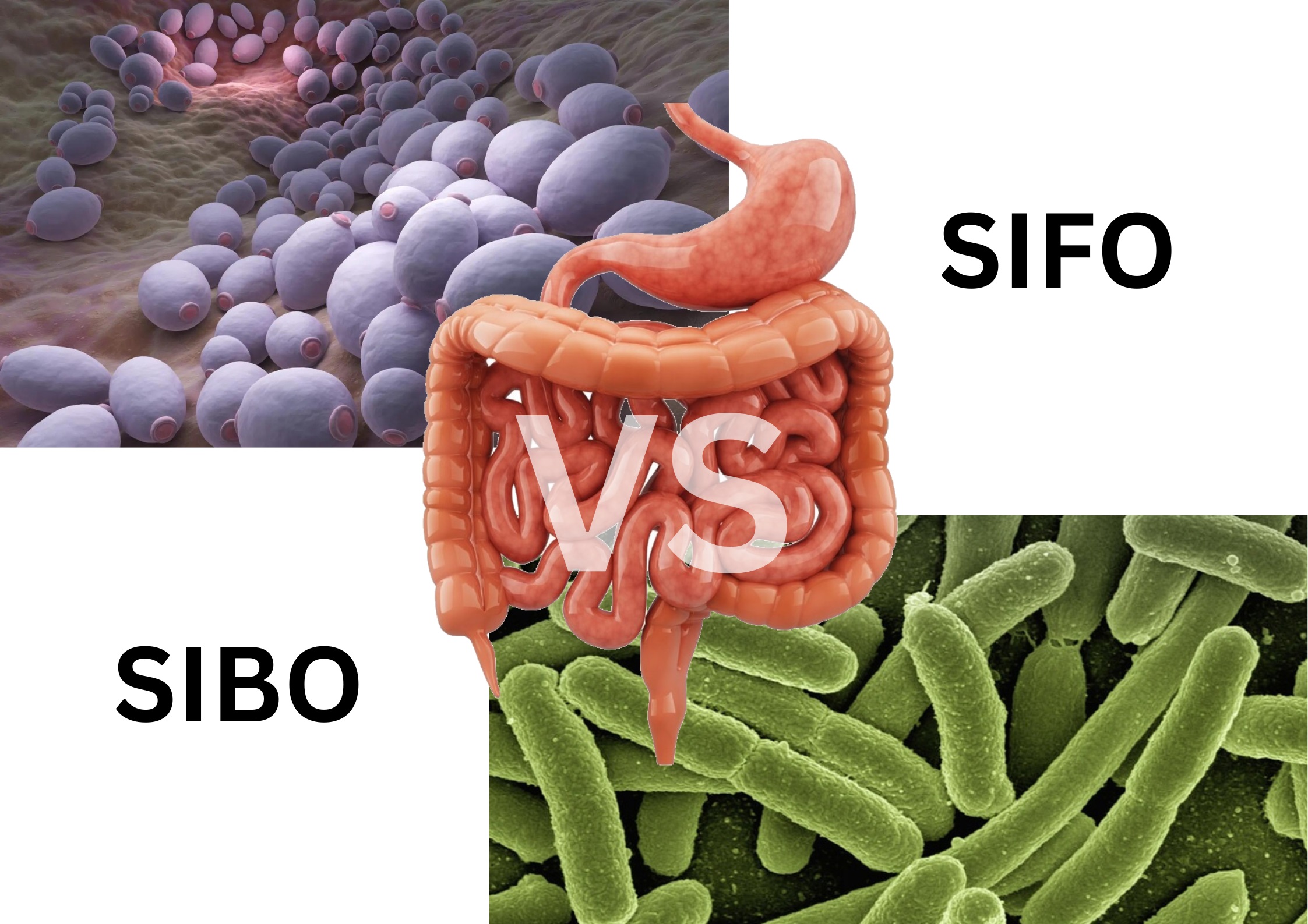 SIFO VS SIBO سيبو و سيفو	