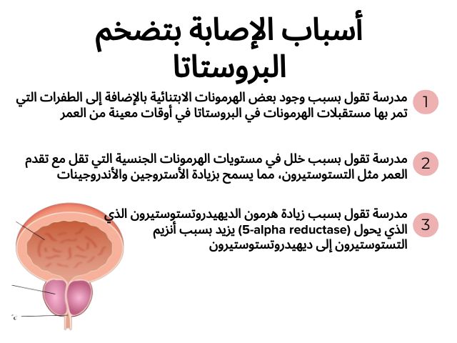 أسباب الإصابة بتضخم البروستاتا